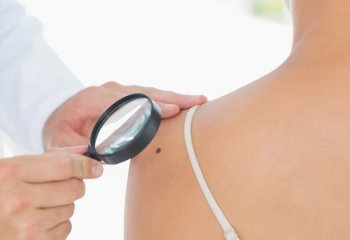 Lettini solari,in 30 anni hanno fatto aumentare tumori pelle